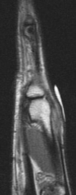 Figure 5 for case Boxers knuckle